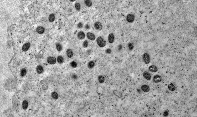 A varíola dos macacos é transmitida pelo vírus monkeypox, que pertence ao gênero orthopoxvirus